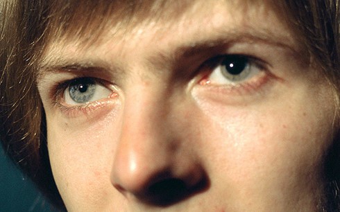 Đôi mắt khác nhau của David Bowie.