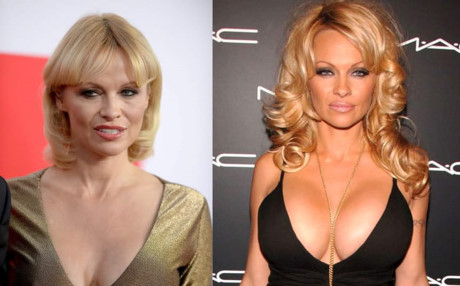 Cô đào nổi tiếng sexy Pamela Anderson với hàng loạt những cuộc phẫu thuật thẩm mỹ trong sự nghiệp - tin rằng dù không thể được coi là một biểu tượng đẹp tự nhiên, cô cũng sẽ không tìm cách chống lại quá trình lão hóa. Từ giờ trở đi cô quyết định sẽ để lẽ tự nhiên làm công việc của mình.