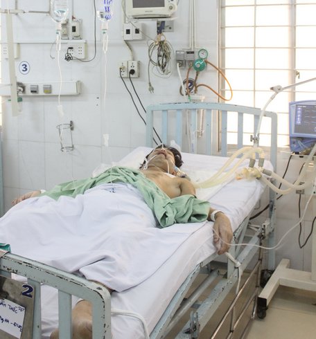 Bệnh nhân chưa đến 60 tuổi điều trị tại bệnh viện tỉnh liên quan đến bệnh lý hô hấp kèm đái tháo đường tuýp 2.