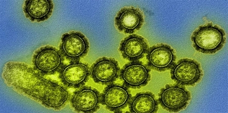 Các dịch bệnh từ vi rút đang xuất hiện với tần suất ngày một nhiều.