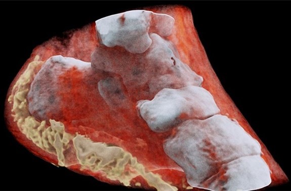 Hình ảnh chụp mắt cá chân người (xương được hiển thị bằng màu trắng và các mô mềm màu đỏ) bằng máy quét X-quang màu
