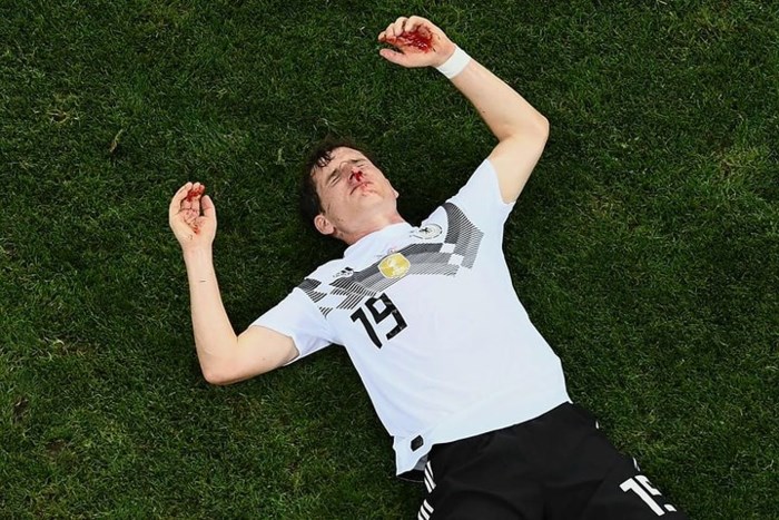Vẻ mặt đau đớn của tiền vệ người Đức Sebastian Rudy sau tình huống va chạm với hậu vệ tuyển Thụy Điển.