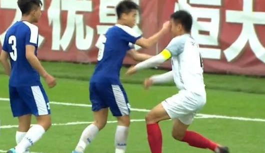 Cầu thủ Đức Anh đấm vào mặt Zheng Haokun của U17 Hebei China Fortune, khiến cầu thủ này phải nhập viện khâu 6 mũi