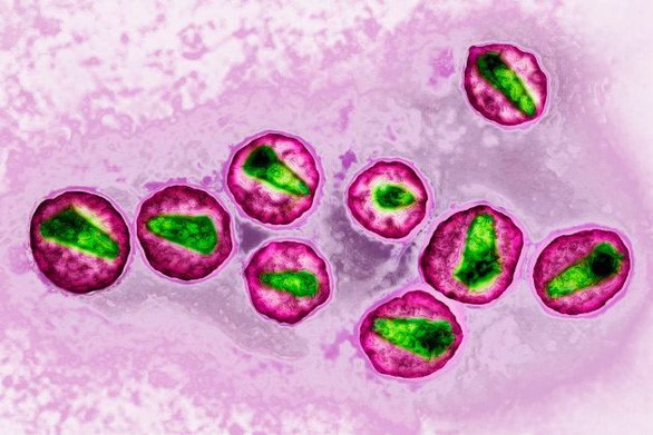 Hình phóng to virus HIV dưới kính hiển vi - Ảnh: CNBC