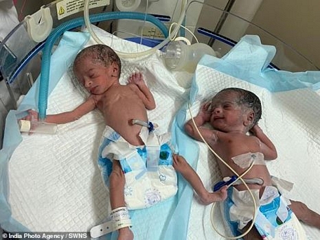  Hai đứa trẻ sinh đôi bằng phương pháp thụ tinh nhân tạo. Nguồn: SWNS