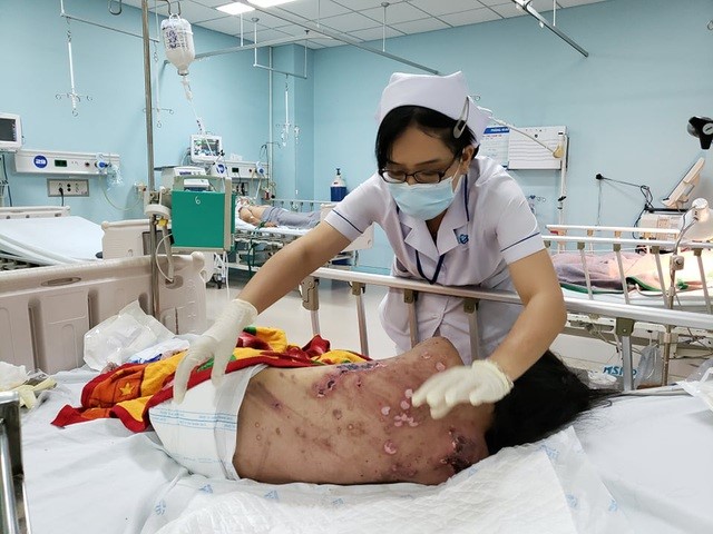 Nạn nhân đang được điều trị tại Bệnh viện Đa khoa Đồng Nai với nhiều vết thương do bị tra tấn trên cơ thể. Ảnh: dantri.com.vn