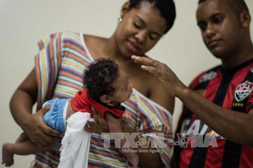 Chăm sóc em nhỏ 2 tháng tuổi mắc chứng đầu nhỏ do virus Zika tại Salvador, Brazil ngày 28/1. Ảnh: AFP/TTXVN