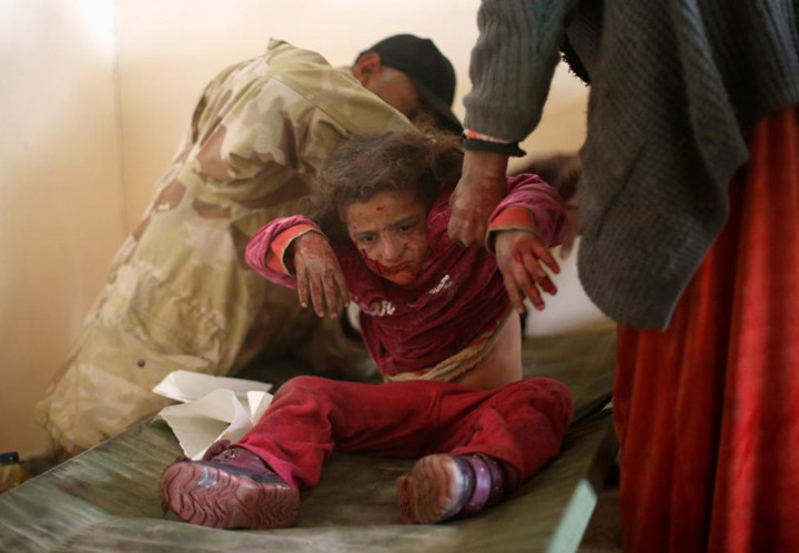 Một bé gái bị thương ở al-Samah được các bác sĩ tận tình chăm sóc.