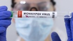 Các biện pháp phòng ngừa bệnh đậu mùa khỉ và những việc cần làm khi mắc bệnh