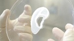 Tai người in 3D được cấy ghép thành công đầu tiên trên thế giới