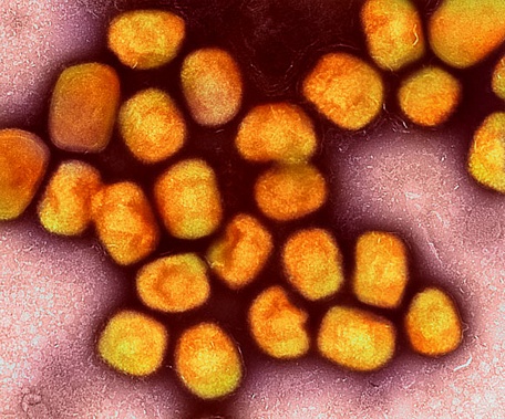  Virus đậu mùa khỉ dưới kính hiển vi - Ảnh NIAID