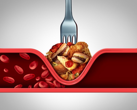 Chế độ dinh dưỡng thiếu khoa học khiến gần 50% người trưởng thành bị mỡ máu cao - Ảnh: Shutterstock