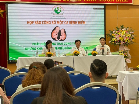 Bệnh viện Phụ sản Hà Nội công bố ca hiếm song thai cùng trứng khác kiểu hình, kiểu gene - Ảnh: D.LIỄU