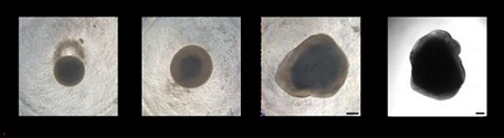 Quá trình phát triển của tế bào não người trong phòng thí nghiệm (từ trái qua phải): sau 7 ngày, 14 ngày, 28 ngày và sau nhiều tháng.      